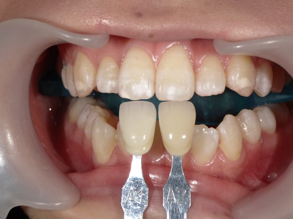 SHOFU DENTAL DIGITAL CAMERA